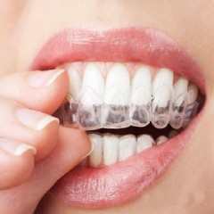 牙齿不齐隐形矫正最低报价——牙齿不齐隐形正畸