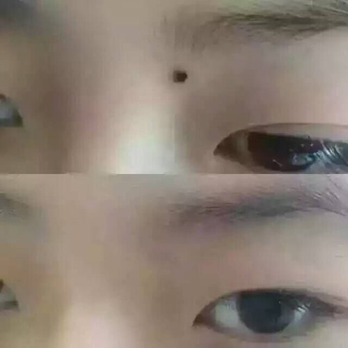 眉山痣缘宫中秋节后上班通知