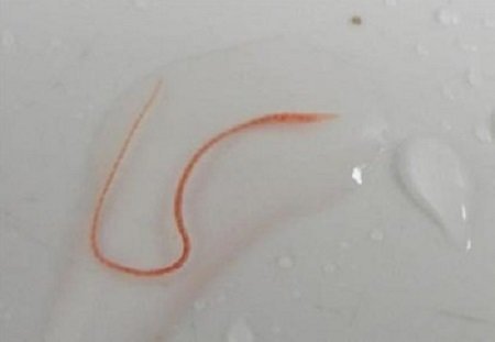 开水都烫不死的寄生虫?水管清洗真的很重要!