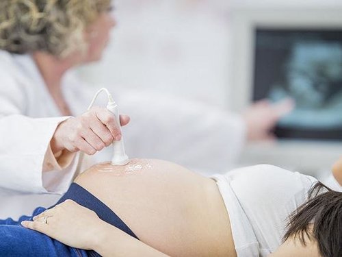 孕妇在分娩前是破羊水还是先出血呢
