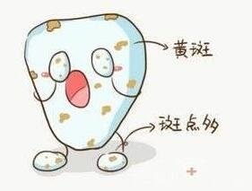 用这些偏方可以暂时缓解牙痛